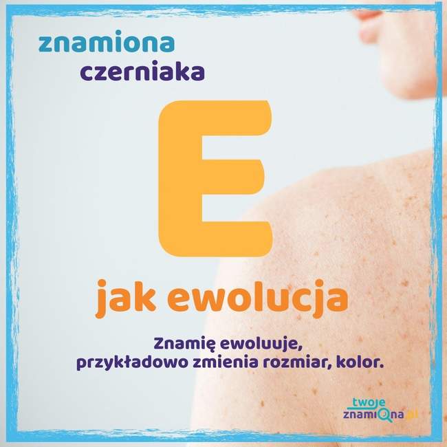 Ewolucja