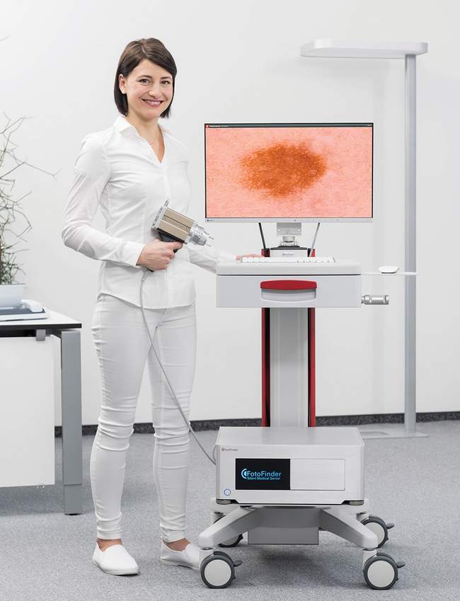 Wideodermatoskop FotoFinder Vexia Medicam 1000 Full HD - stacjonarna wersja systemu komputerowego badania znamion dermatoskopia cyfrowa