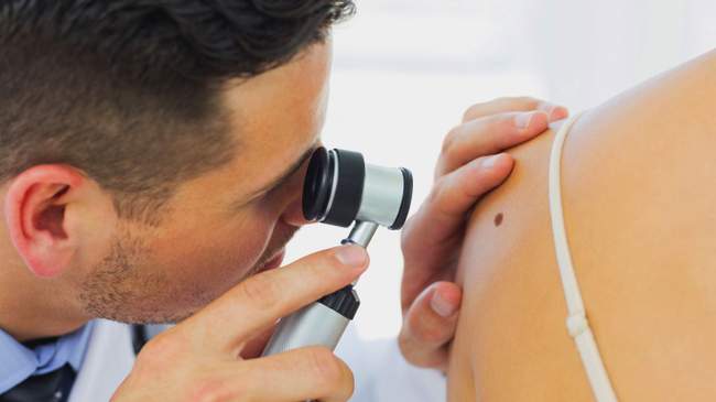 Badanie znamion (pieprzyków) za pomocą dermatoskopu.