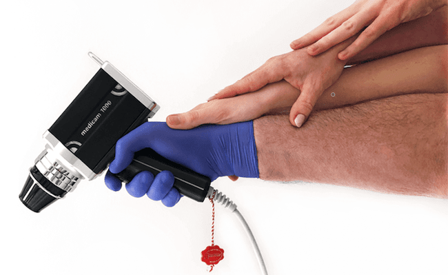 Kamera wideodermatoskopu